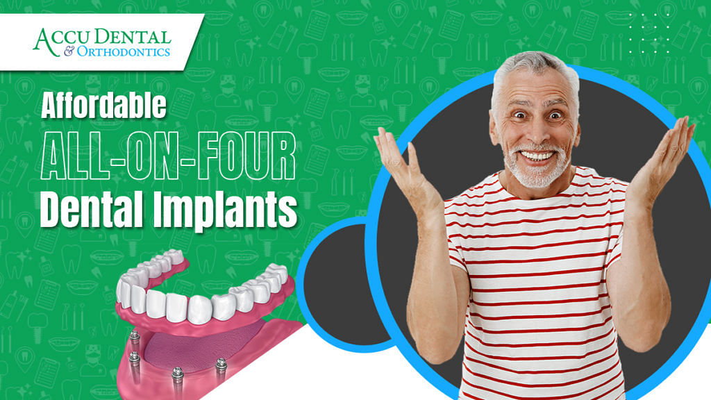 Aftercare Tips For All On 4 Dental Implants Accu Dental